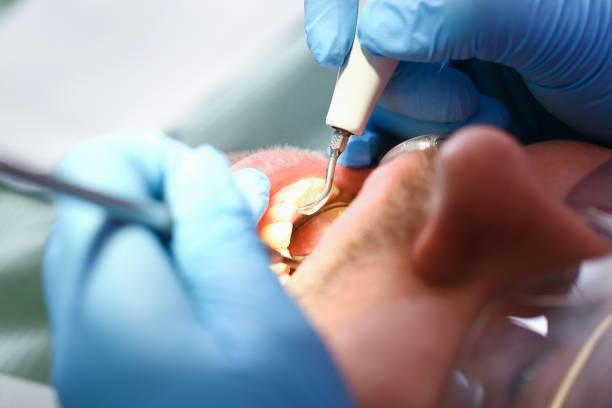 Best Emergency Dental Care for Broken or Chipped Teeth in Dexter, GA